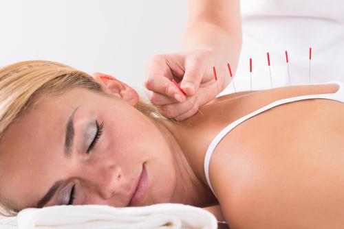 Laser Therapy - image ss-acupuncture-blond on https://www.drlisaowen.com